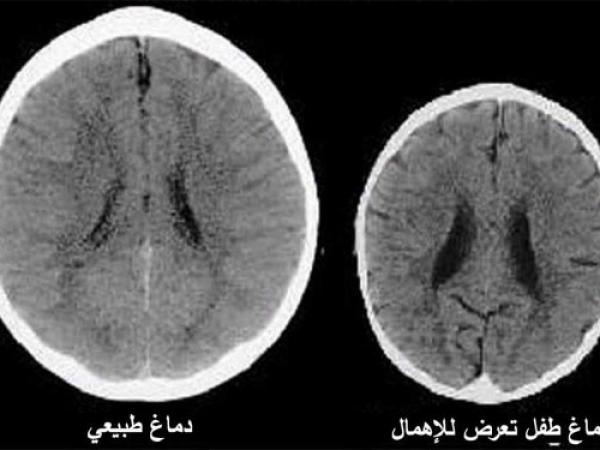 العلماء يكتشفون بالصور تأثير تربية الأم على دماغ أولادها